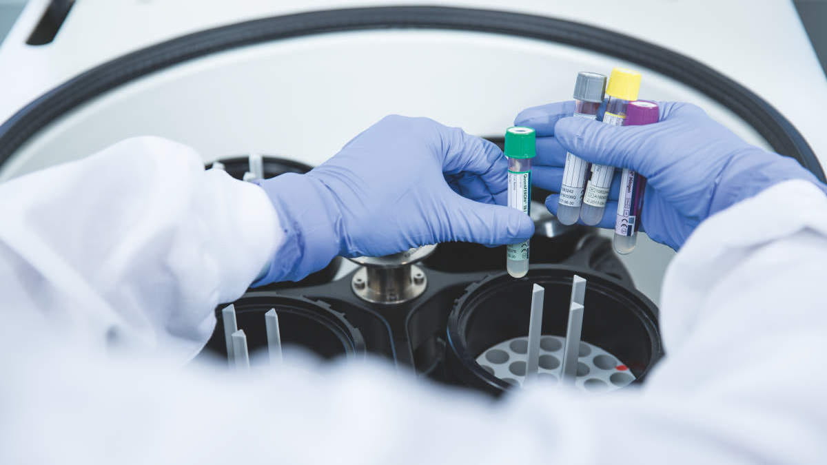 Improve your tuberculosis testing with QuantiFERON